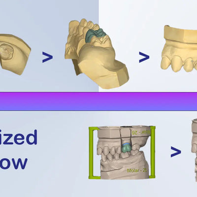 Modélisation dentaire