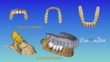 Professional CAD CAM Dental Design For Custom Prosthetic From Intraoral Scans Exocad Ready For 3D Printing And Milling