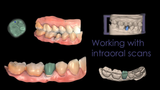 Professional CAD CAM Dental Design For Custom Prosthetic From Intraoral Scans Exocad Ready For 3D Printing And Milling