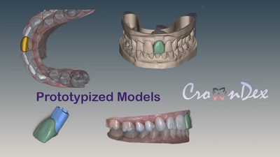 Dental Model Prototyping