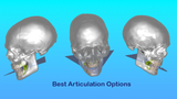 Professional CAD CAM Dental Design For Custom Prosthetic From Intraoral Scans Exocad Ready For 3D Printing And Milling