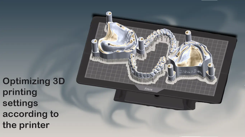 Dental Model Prototyping