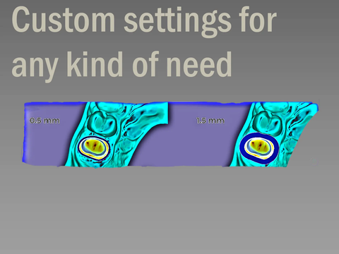 Professional CAD CAM Dental Design For Custom Prosthetic From Intraoral Scans Exocad Ready For 3D Printing And Milling