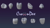 Professional CAD CAM Dental Design For Custom Prosthetic From Intraoral Scans Exocad Ready For 3D Printing And Milling