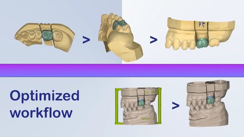 Dental Model Prototyping