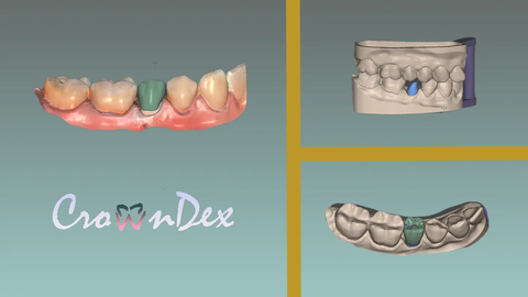 Dental Model Prototyping
