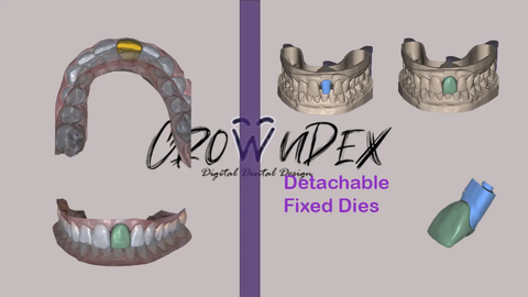 Dental Model Prototyping