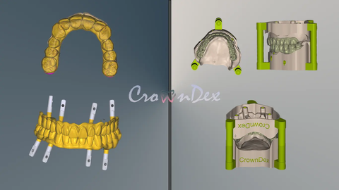 Dental Model Prototyping