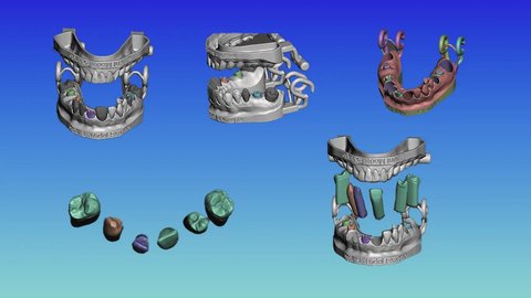 Dental Model Prototyping