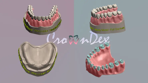 Dental Model Prototyping